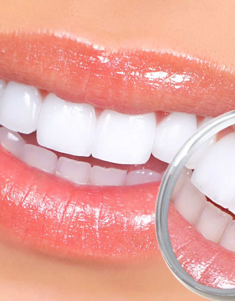 diseñamos-sonrisas diseñamos-sonrisas