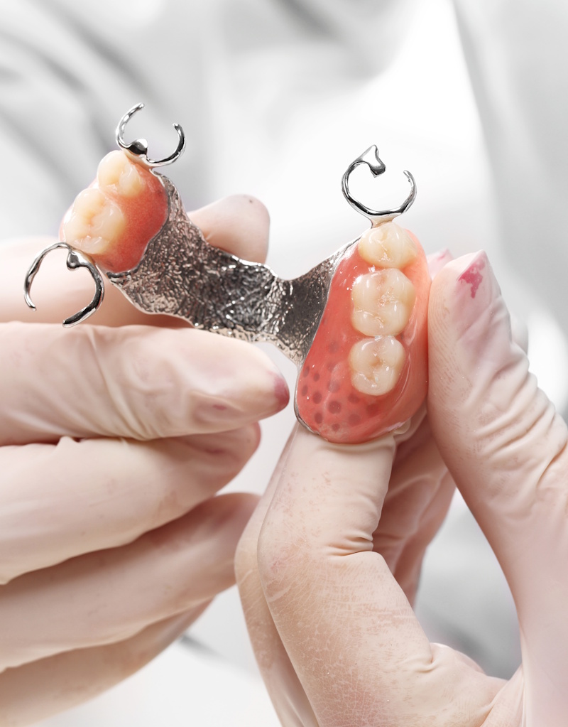fases-protesis-dental fases-odontopediatria